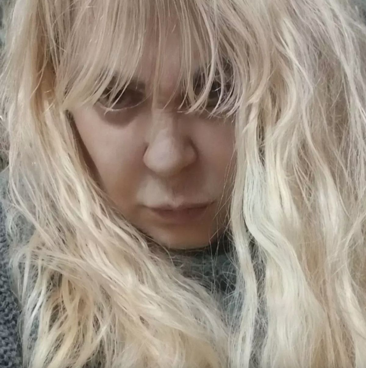 Zerrin Özer’in Sağlık ve Vasiyet Hikayesi: Zorlu Süreçte Umut Işığı