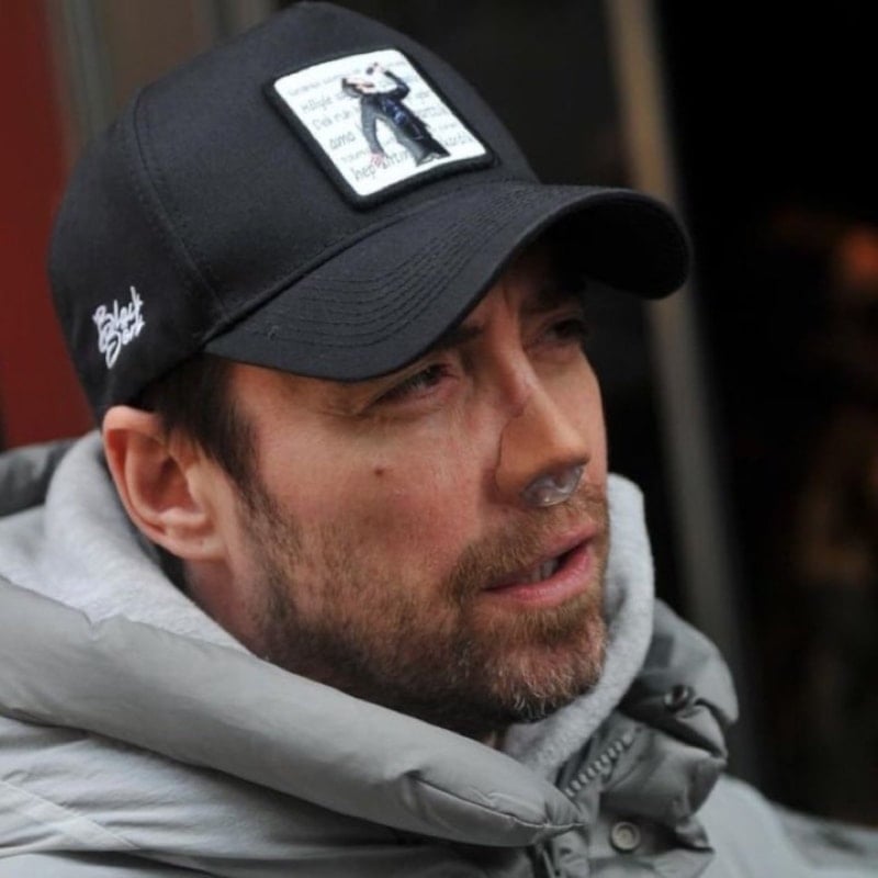 Murat Dalkılıç 13. Ameliyatında Yeniden Operasyon Masasında